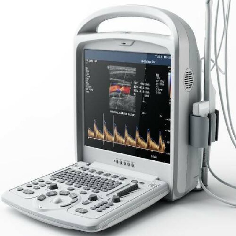 PT9600 2D Portable Color Doppler Ultrasonic Diagnostic System