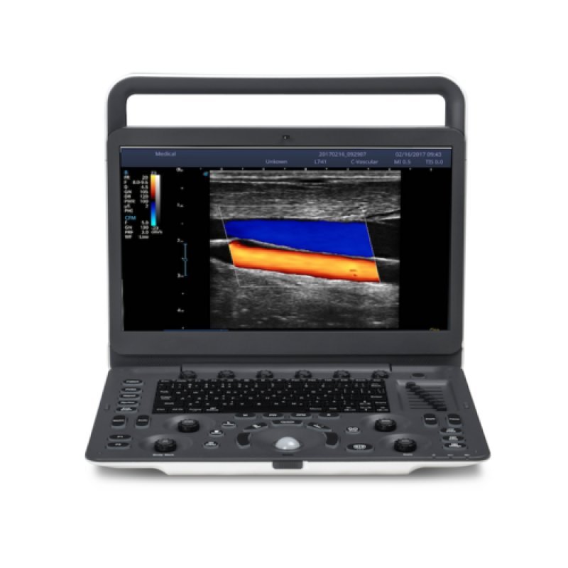Sonoscape E2 Ultrasound Machine