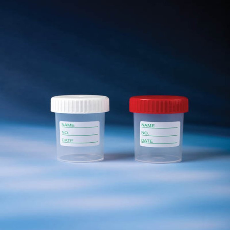Specimen Containers 60 ML-PP-With Label