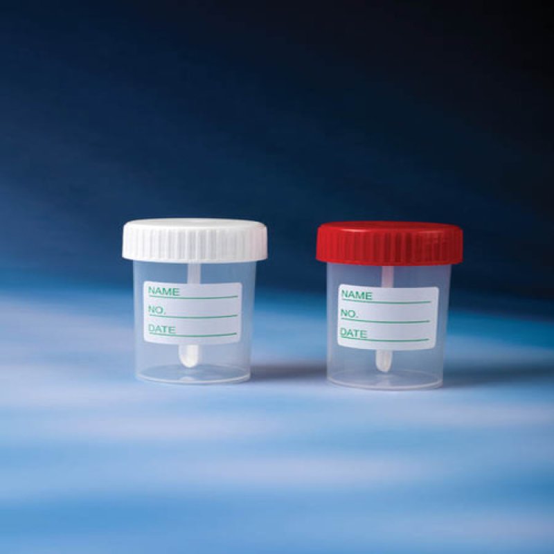 Specimen Containers 60 ML-PP-With Label & Spoon