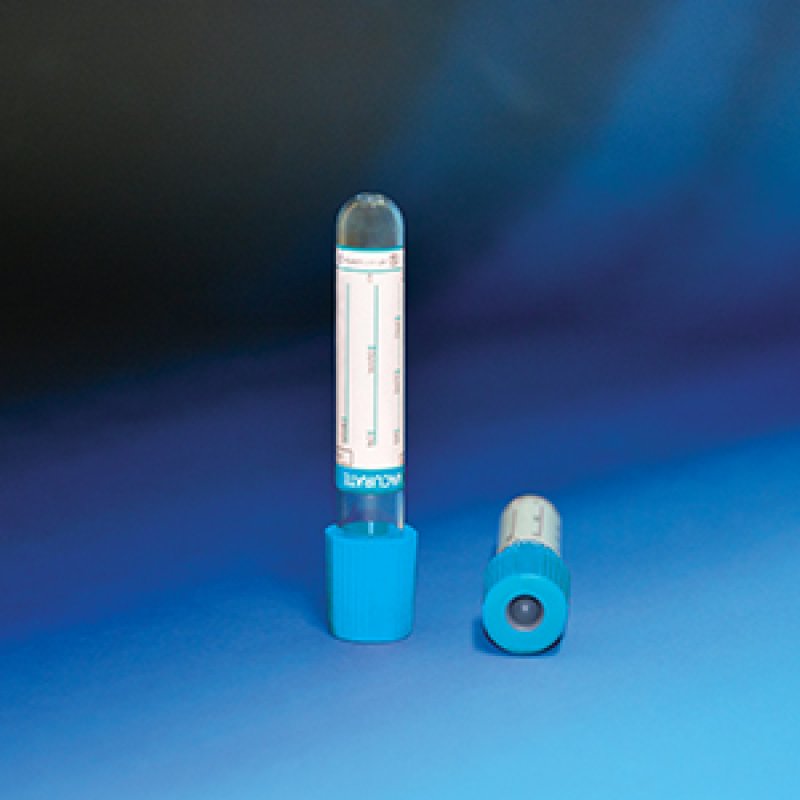 Vacuum Blood Collection Tubes- Sodium Citrate 3.8%