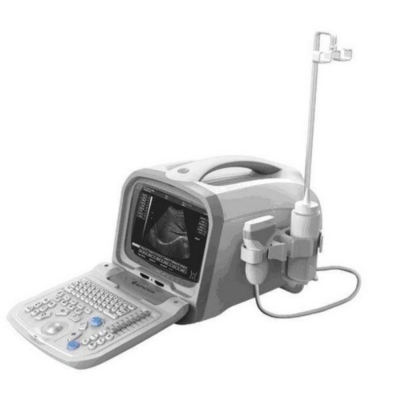 Portable Ultrasound Scanner PT6601 (Black/White)