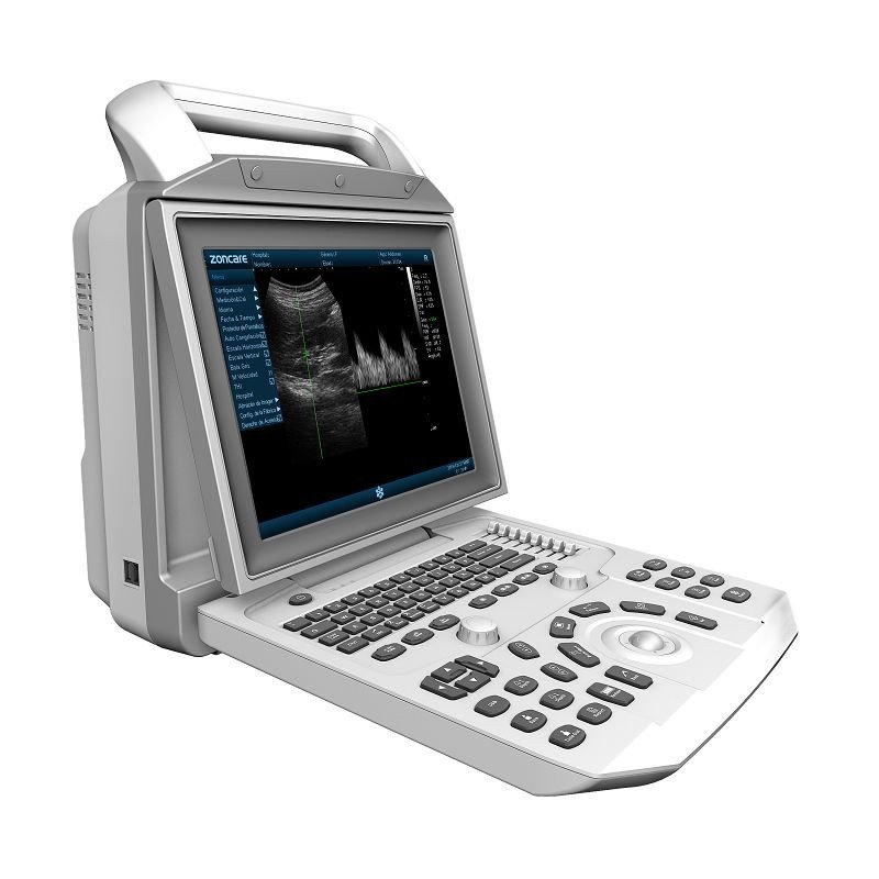 Featured Product of the Week: ZONCARE i50 ULTRASOUND